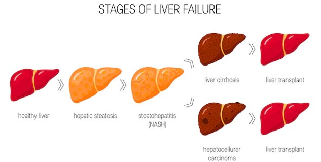 prevent liver diseases