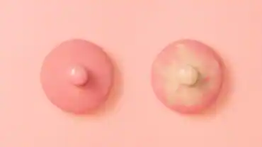 nipple problems