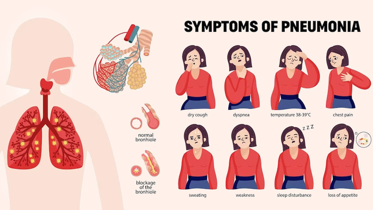 Signs and symptoms of pneumonia