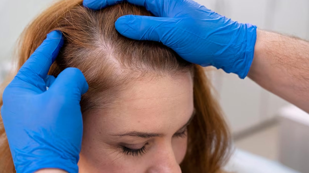 scalp-eczema-test