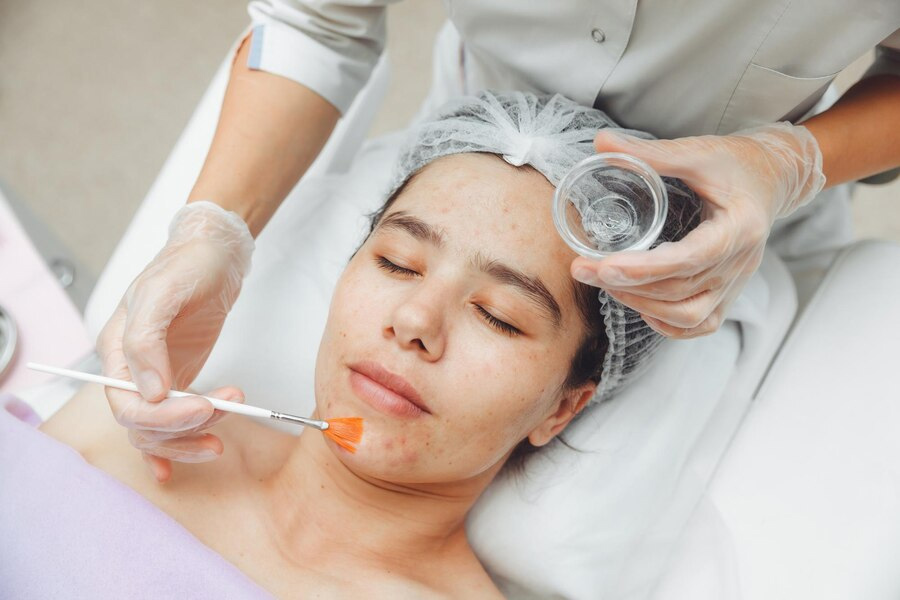 Complications To Watch Out For Before Getting A Chemical Peel Skin Treatment