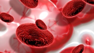 Graphic representation of a blood clot