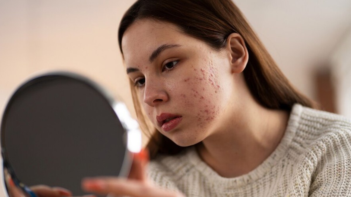 Signs And Treatment Of Urban Dust Skin Effect